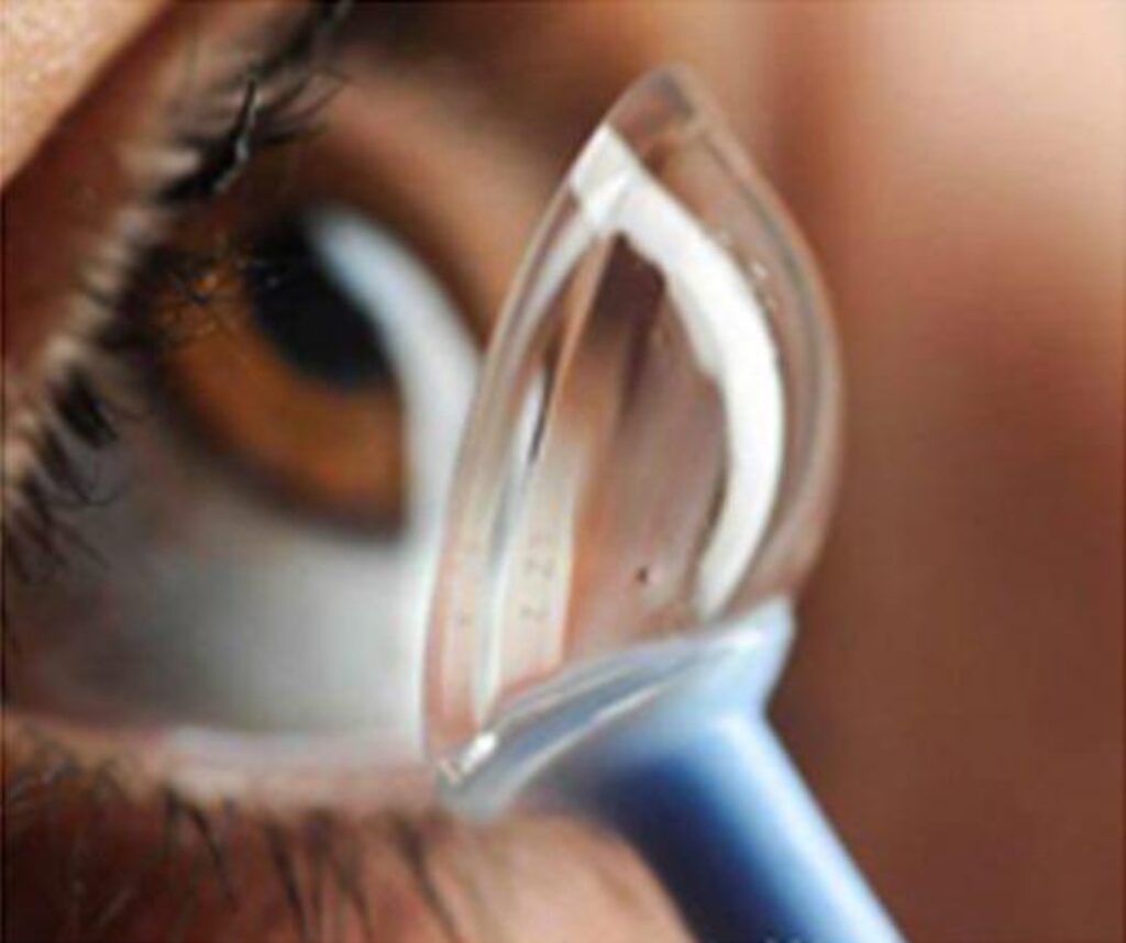 Contact Lens Services